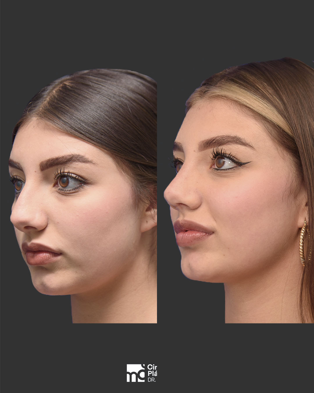 Perfil