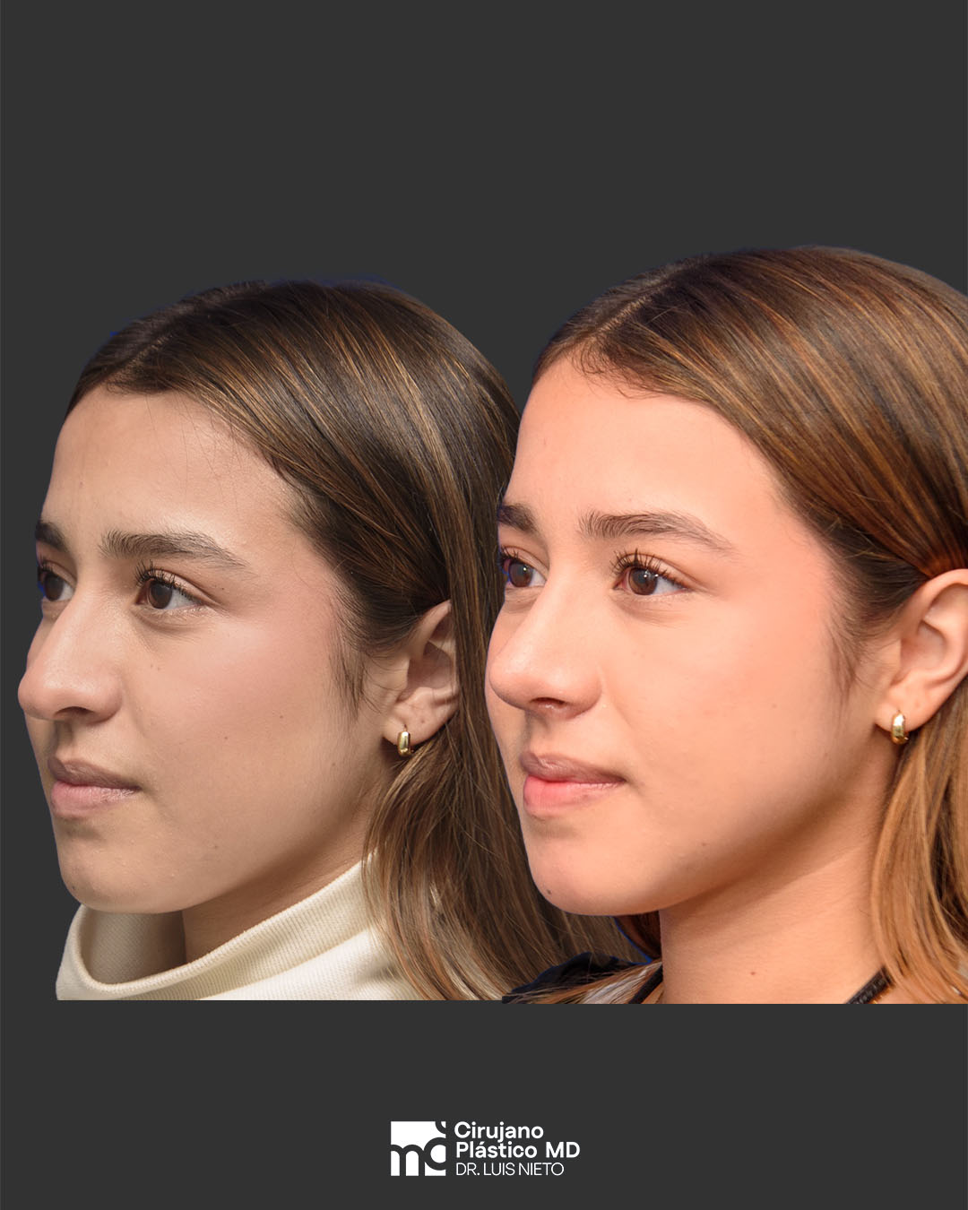 Perfil