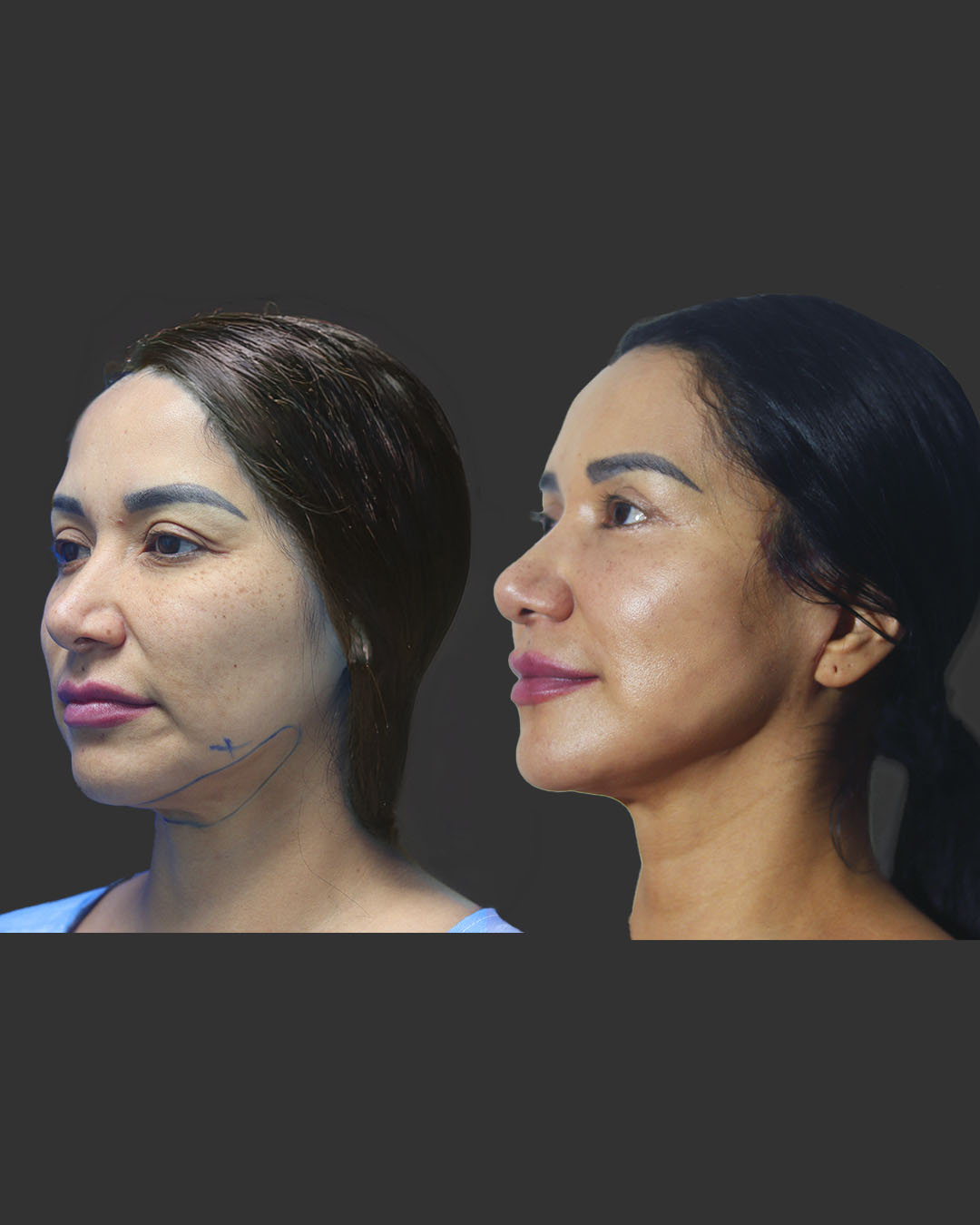 Perfil