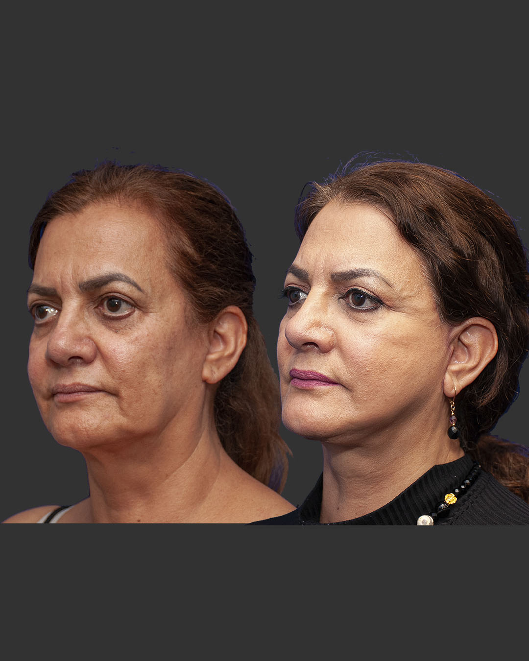 Perfil